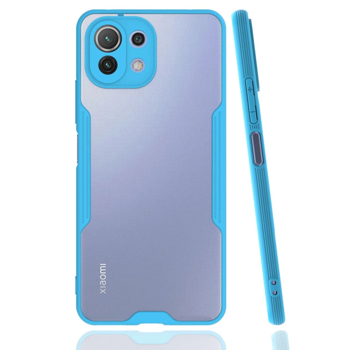 Xiaomi Mi 11 Lite Kılıf Platin Silikon - Mavi