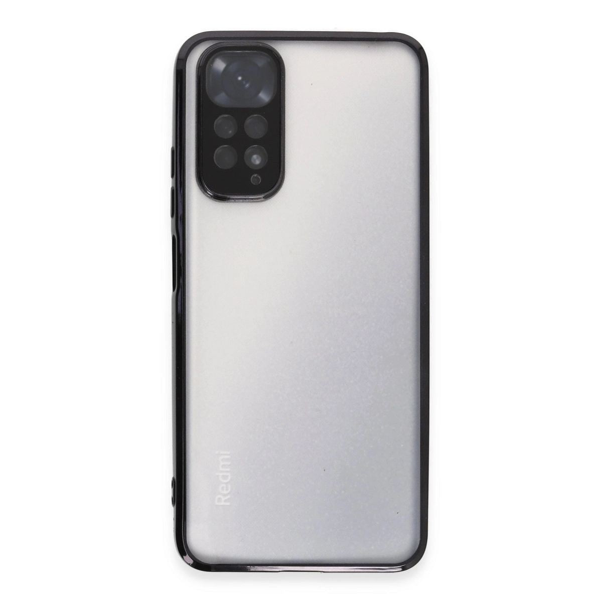 Xiaomi Redmi Note 11 Kılıf Razer Lensli Silikon - Siyah