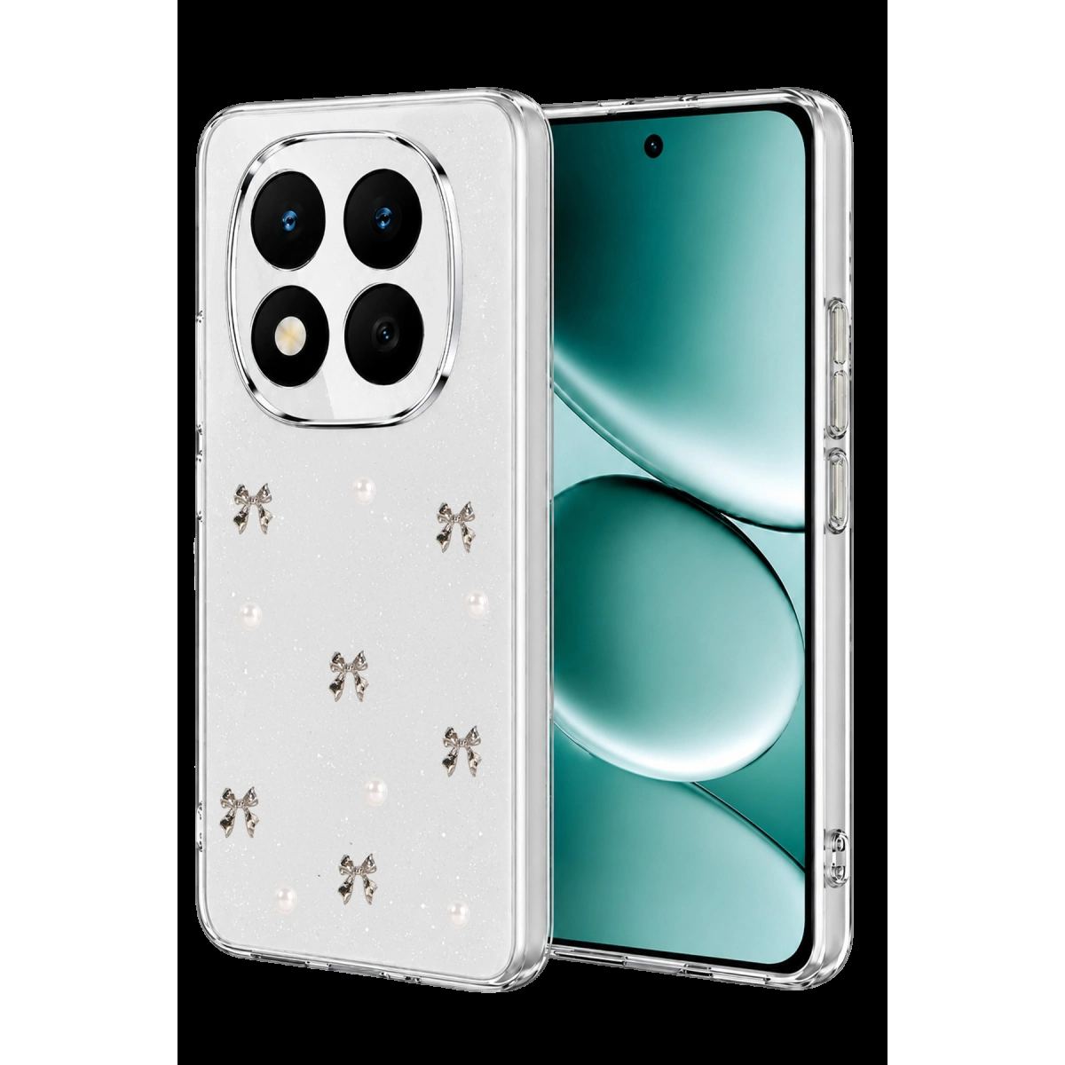 Xiaomi Redmi Note 15 Pro 5g Fiyonk Desenli Kapak - Desen 8
