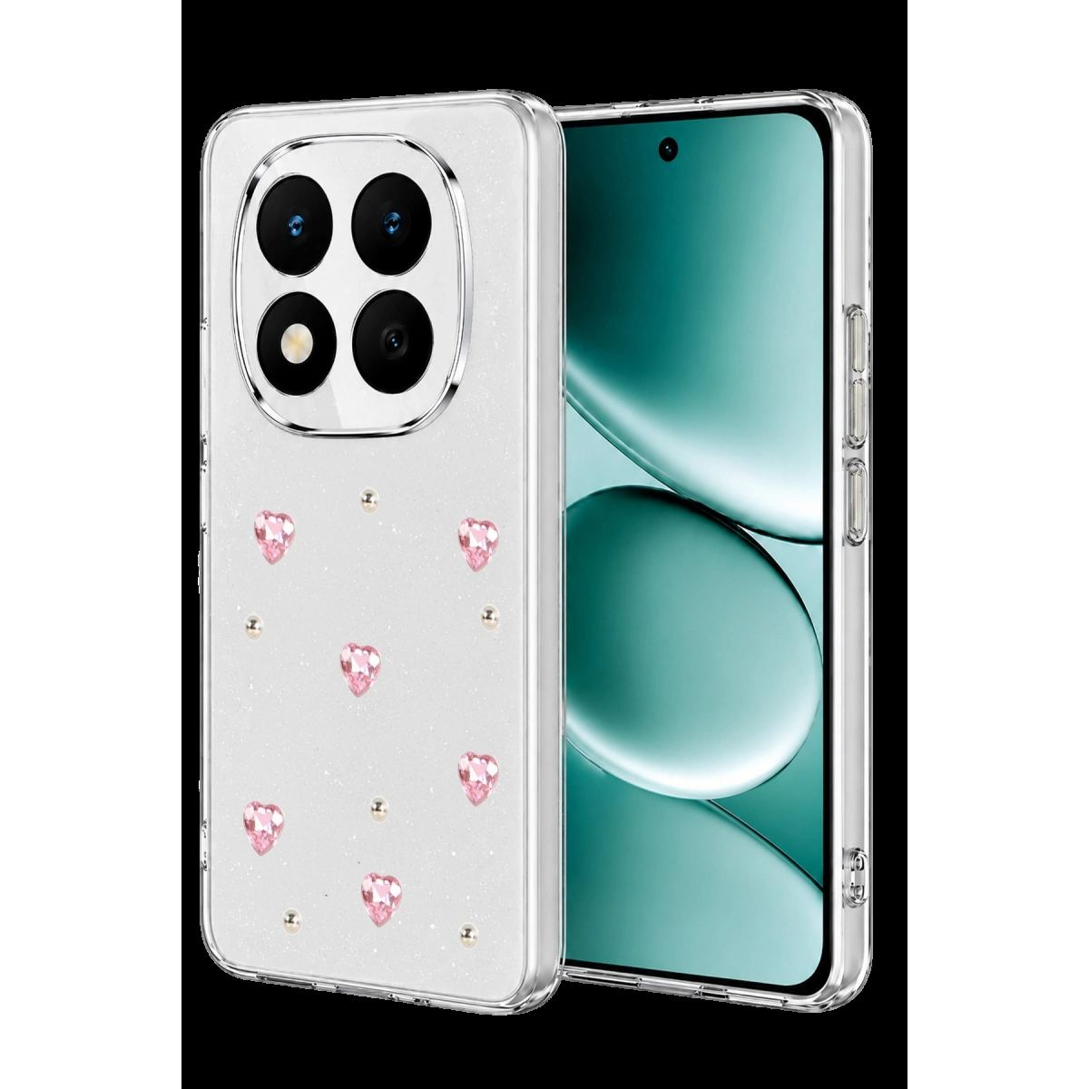 Xiaomi Redmi Note 15 Pro Plus 5g Fiyonk Desenli Kapak - Desen 3